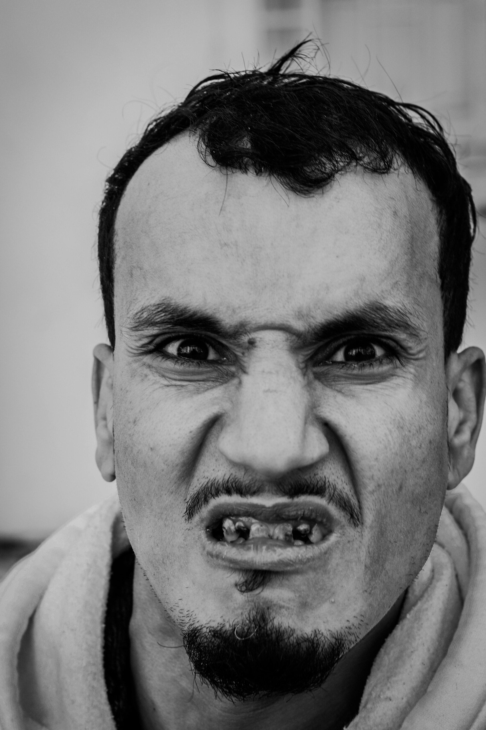 man scowling at the camera