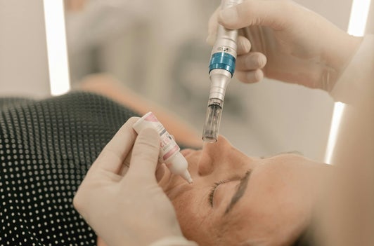 Microneedling