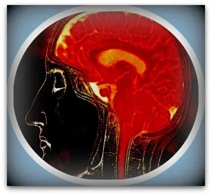 Sore Brain Encephalitis / Brain Injury caused by infection / Types of brain injury ...