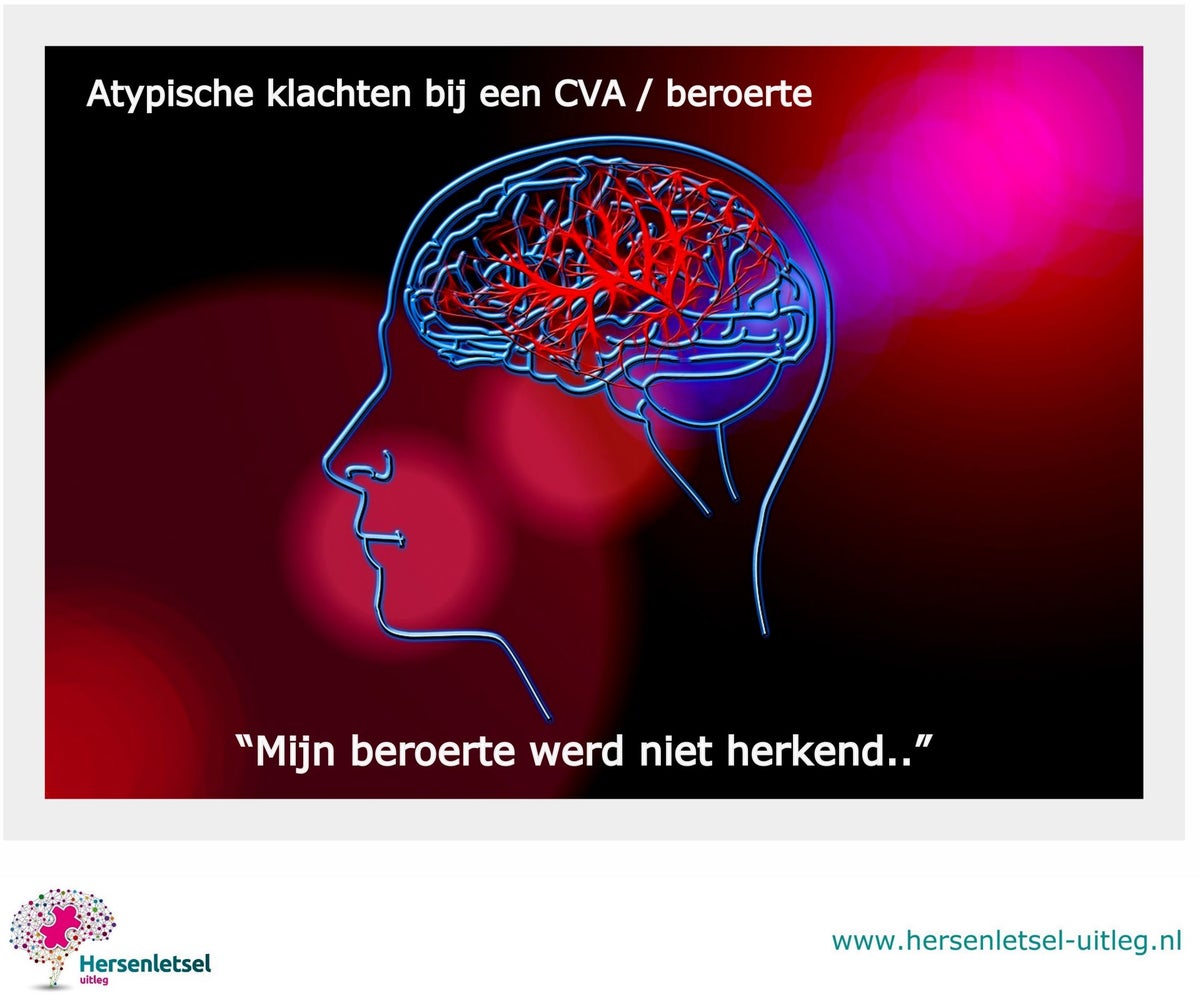 Mijn beroerte werd niet herkend