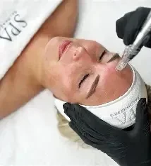 Microneedling