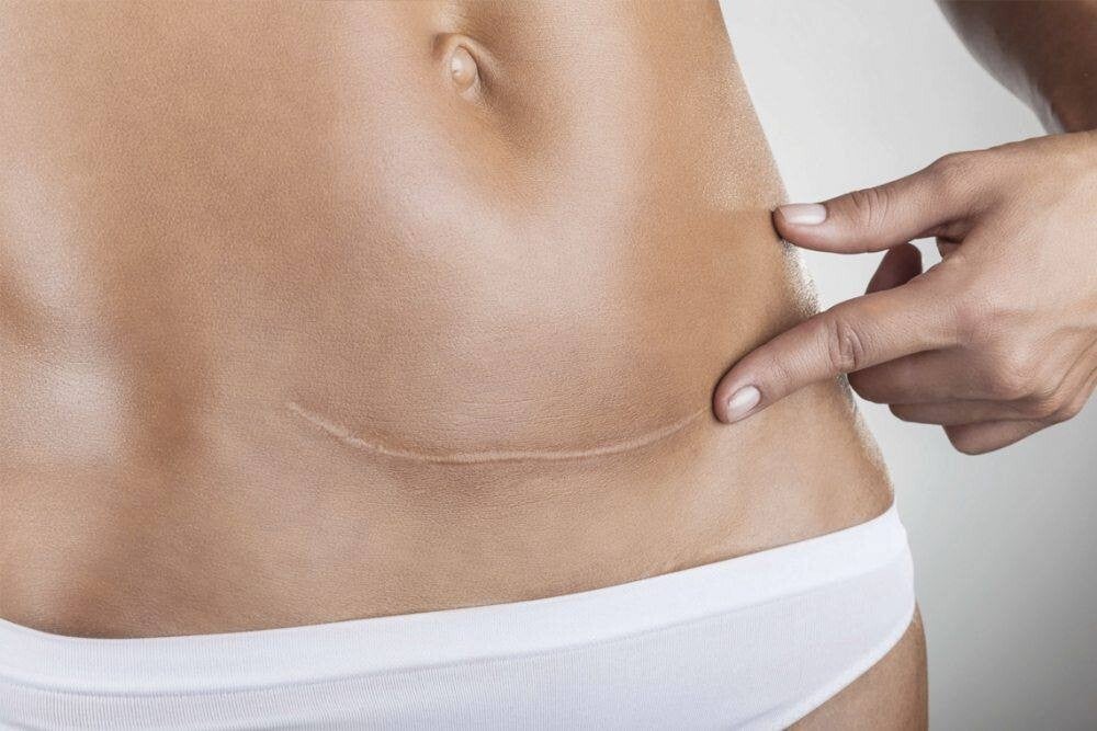 Cefalees i dolor cervical