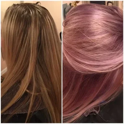 before-amd-after-1-standard.webp