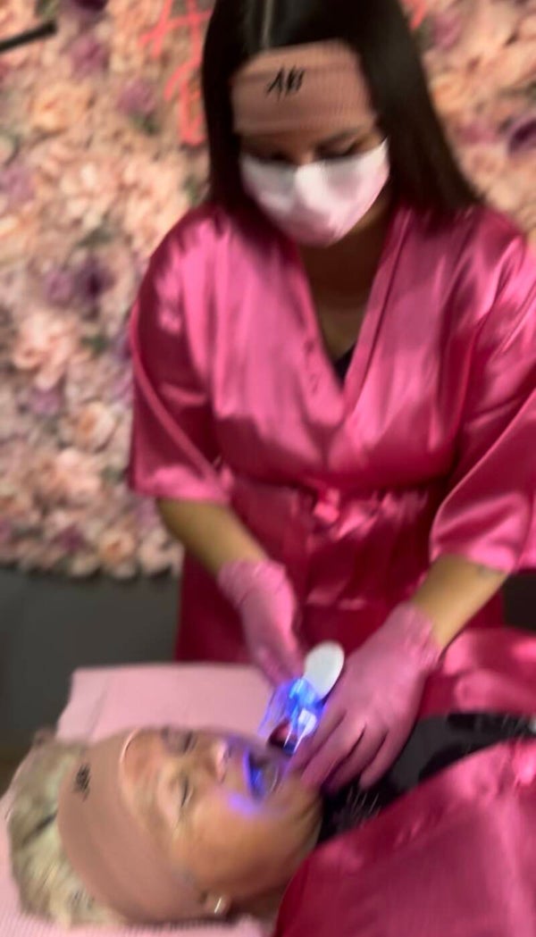 Curso bloom shine blanqueamiento dental