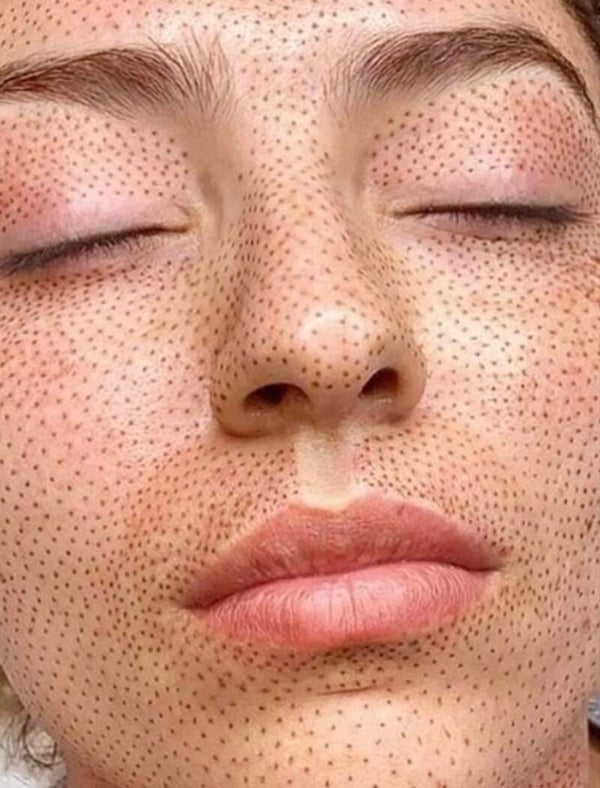 Curso bloom PLASMAPEN LIFT AVANZADO HD