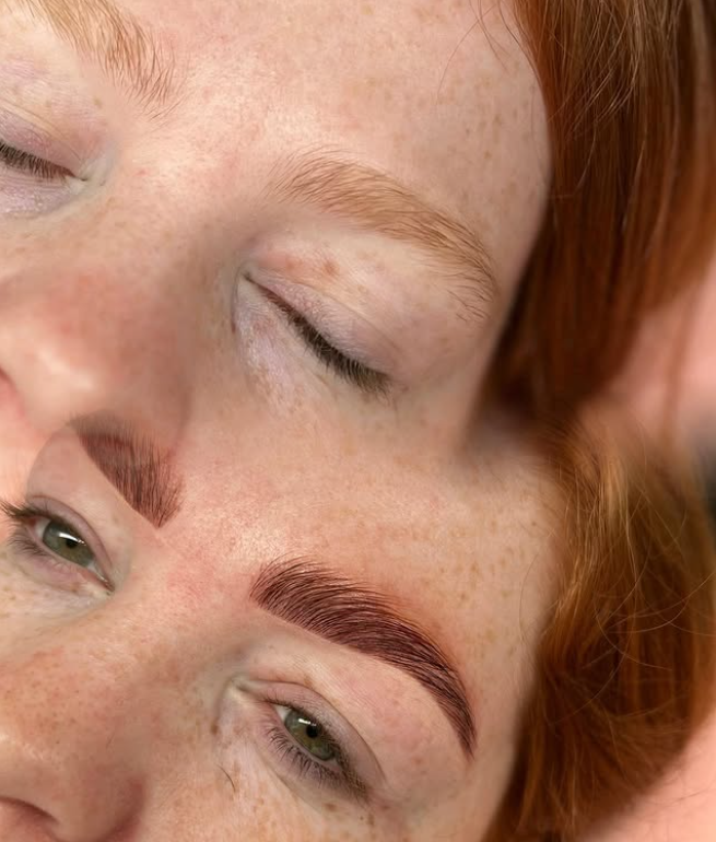 browlamination-standard.png
