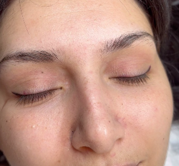 Hyperrealisme Wenkbrauwen-behandeling