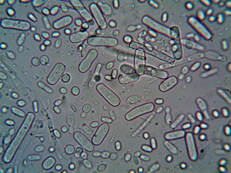 El Síndrome de Sobrecrecimiento Bacteriano del Intestino Delgado (SIBO) es una condición digestiva en la que hay un exceso de bacterias en el intestino delgado. Este sobrecrecimiento puede 