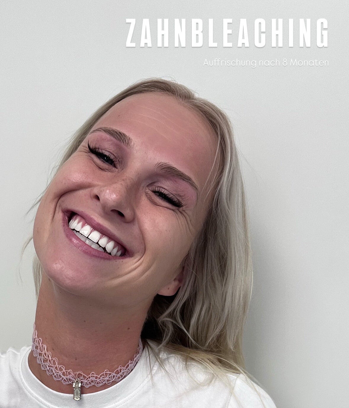 Kosmetisches Zahnbleaching Schulung