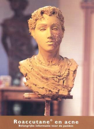 Acne 1999 tbv patientenfolder
