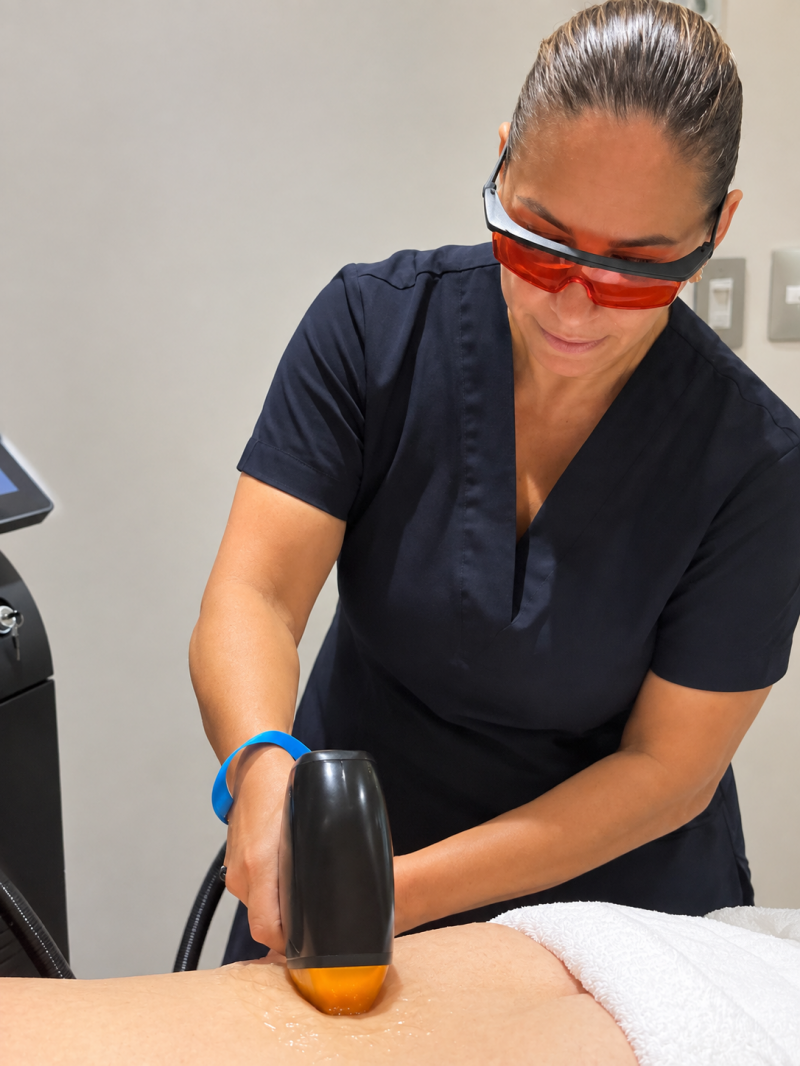 Laser hair removal