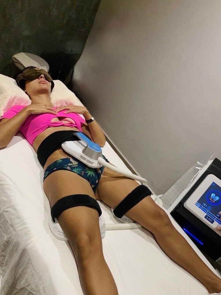 HIFEM body sculpting results on female abdominal muscles