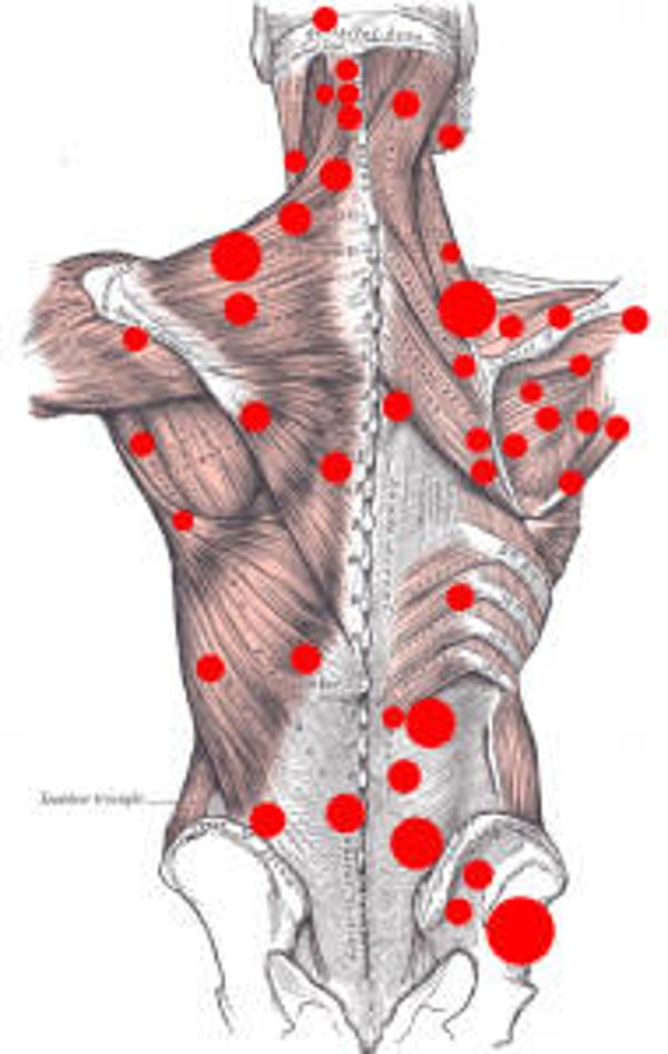 Triggerpoint Massage