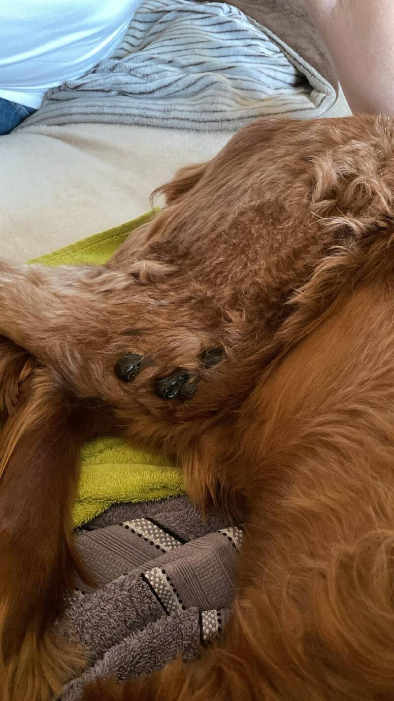 Blutegeltherapie