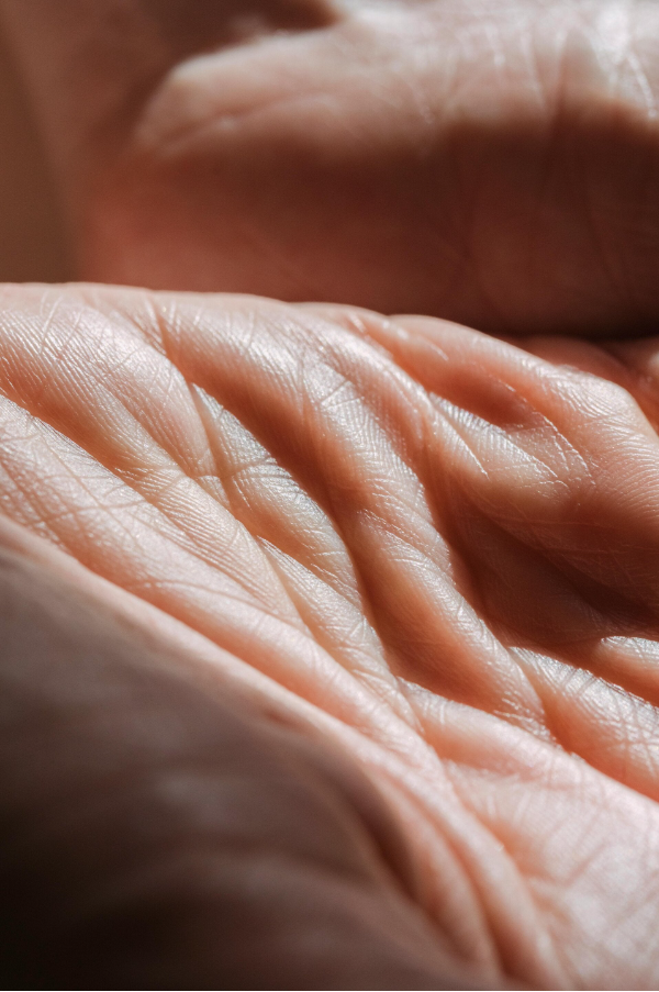 Close-up van droge huid met zichtbare schilfering