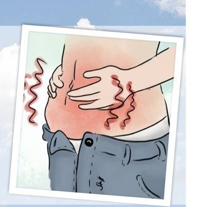 Синдром на раздразненото черво