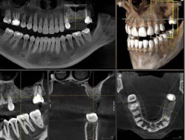 Large Field of View CBCT