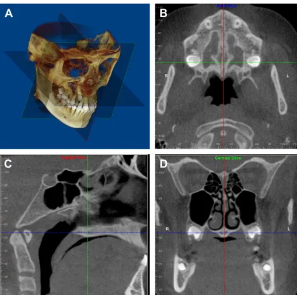 Large Field of View CBCT
