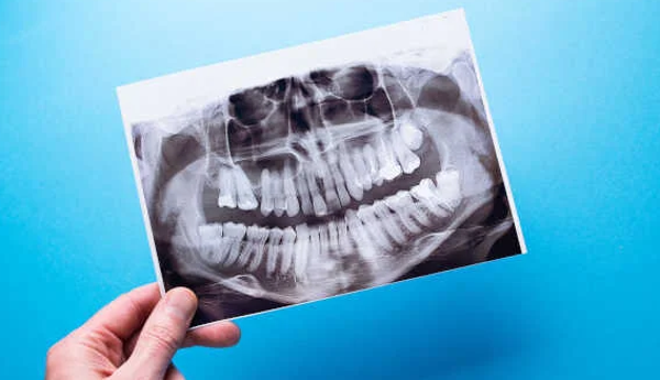 Panoramic image and intraoral images packages