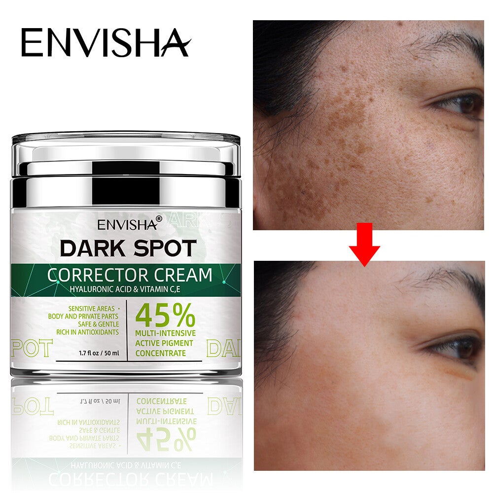 Envisha Face Skin Care Whitening Freckle Cream Remove Melasma Dark