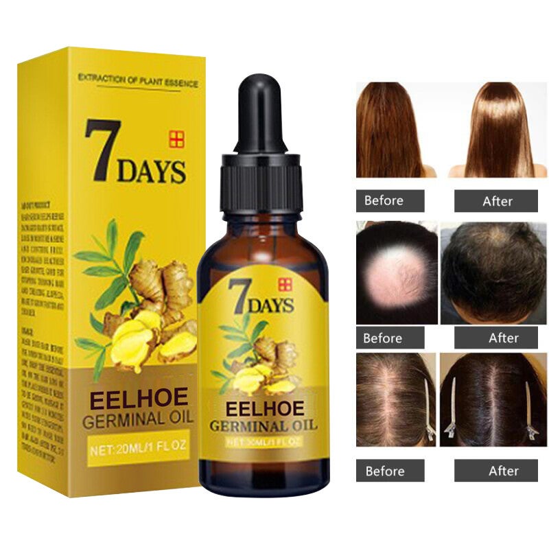 Ginger Hair Growth Products Fast Growing Hair Essential Oil Natural