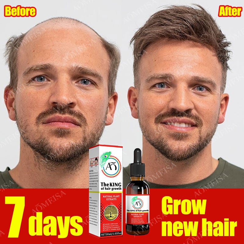 Hair Growth Oil Fast Hair Growth Effective Baldness Repair Hereditary