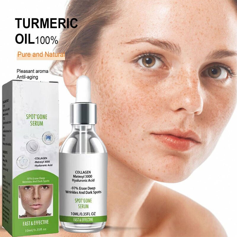 Anti spot Remove freckles, chloasma, dark spots, hyperpigmentation,