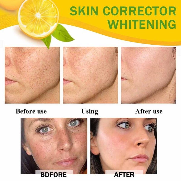 Organic Whitening Cream, Dark Spot Repair Cream, Remove Melanin