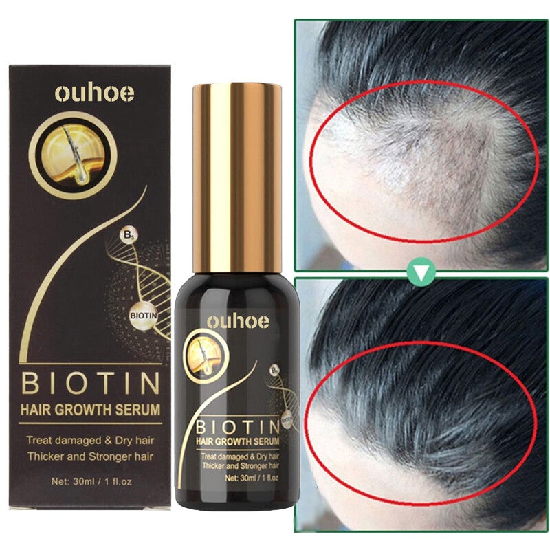 Hair Growth Serum Anti Hair Loss Essential Oils Prevent Baldness Scalp