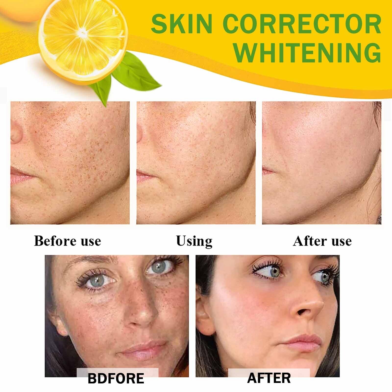 Organic Whitening Cream, Dark Spot Repair Cream, Remove Melanin