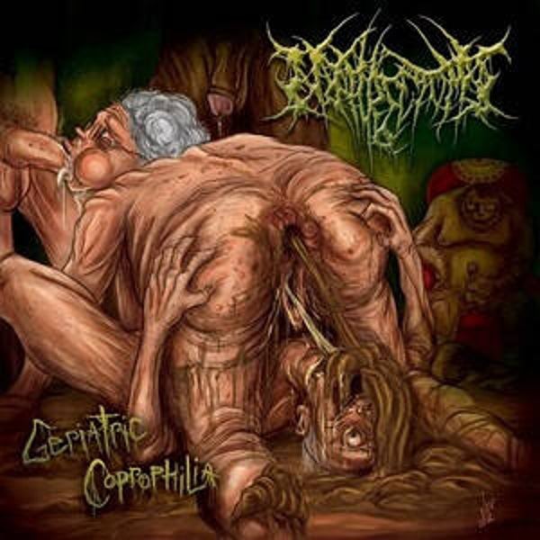 NEPHRECTOMY