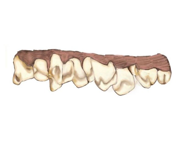 Digital Teeth