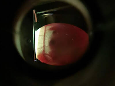 Gjennomlysning av egg - dag 12