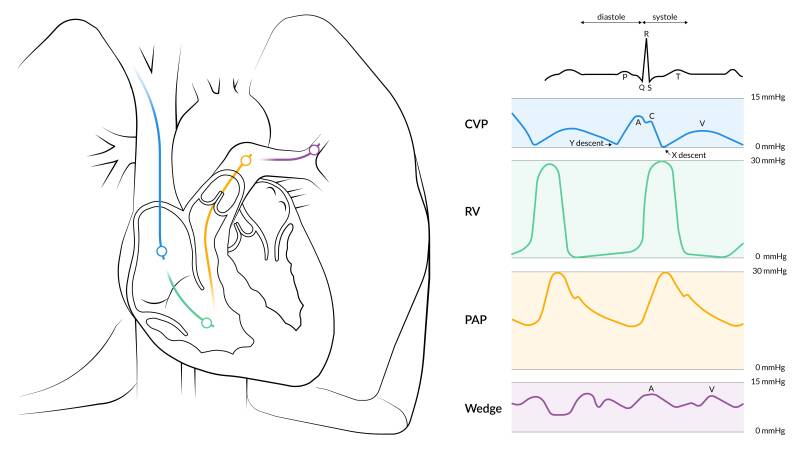 wetenschappelijke illustratie cardiologie