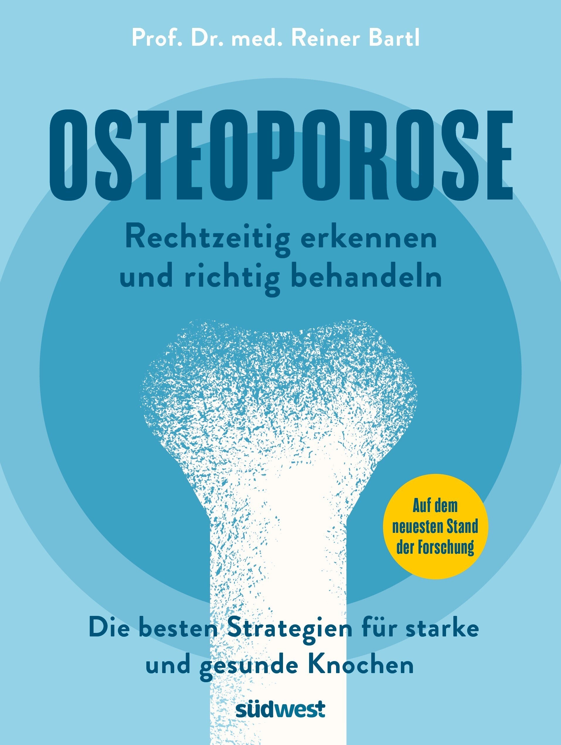 Cover zum Buch Rezension:  "Osteoporose - Rechtzeitig erkennen und richtig behandeln" von Prof. Dr. med. Reiner Bartl