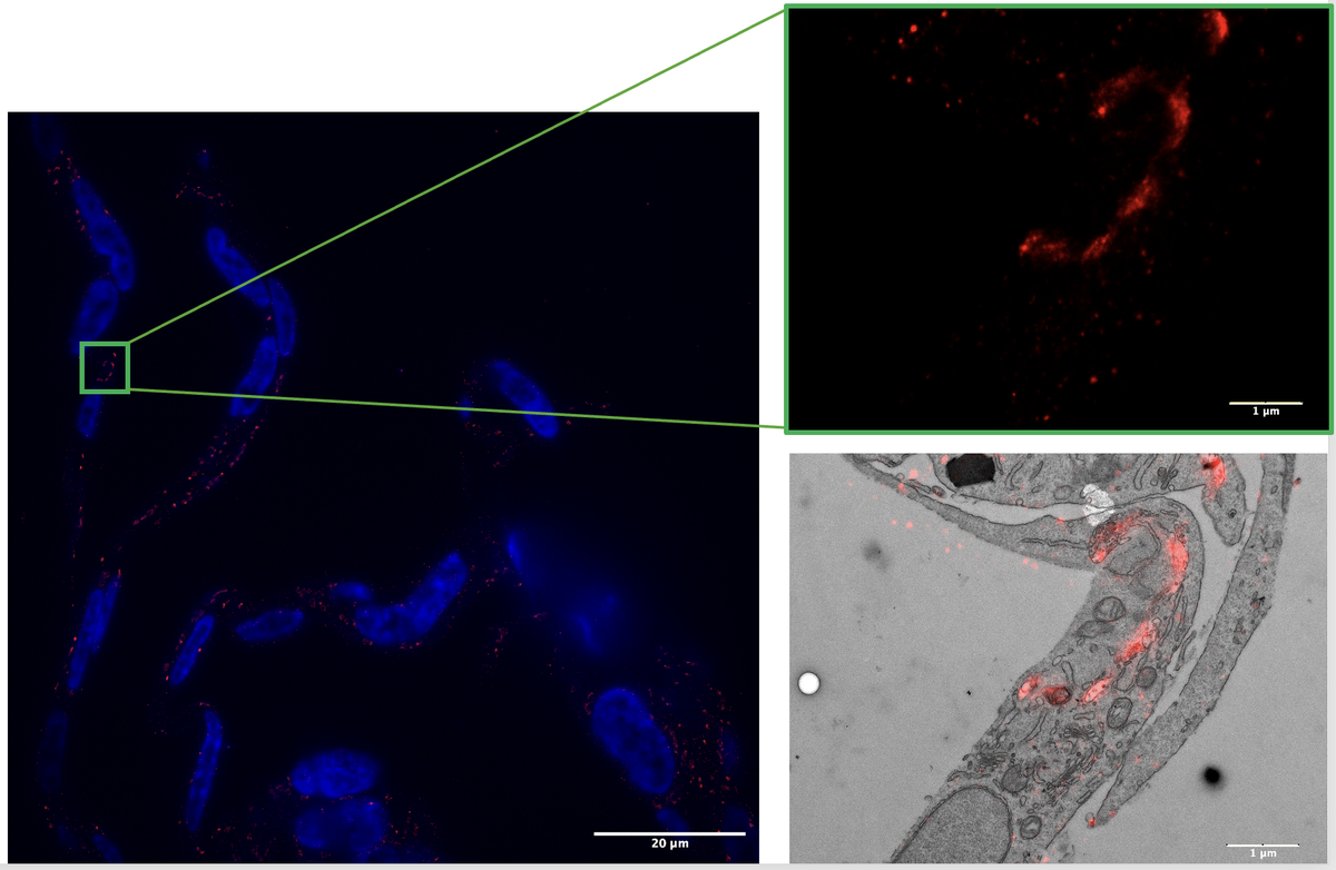 GdN_microscopy