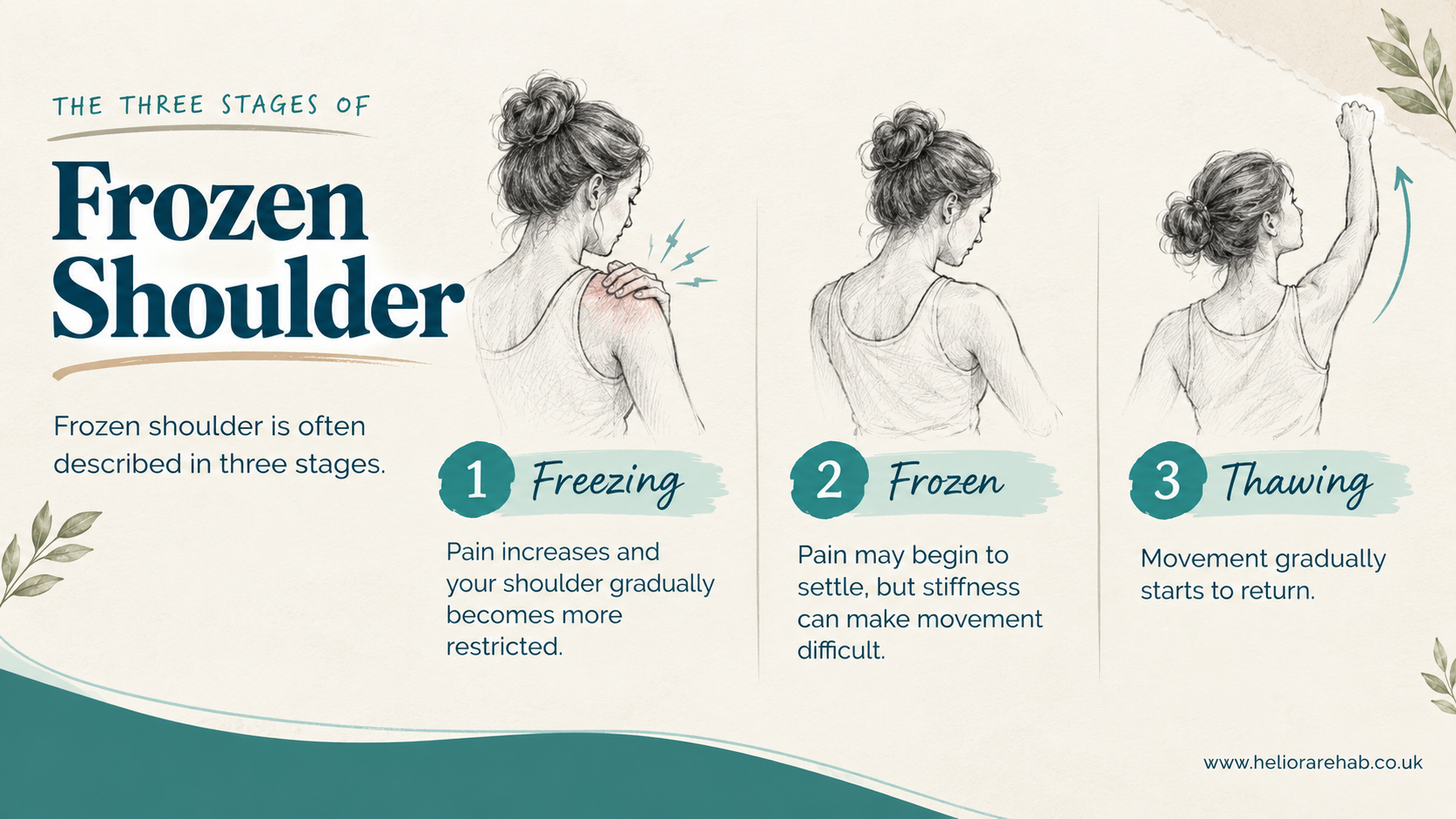 Frozen shoulder infographic showing the freezing, frozen and thawing stages of adhesive capsulitis