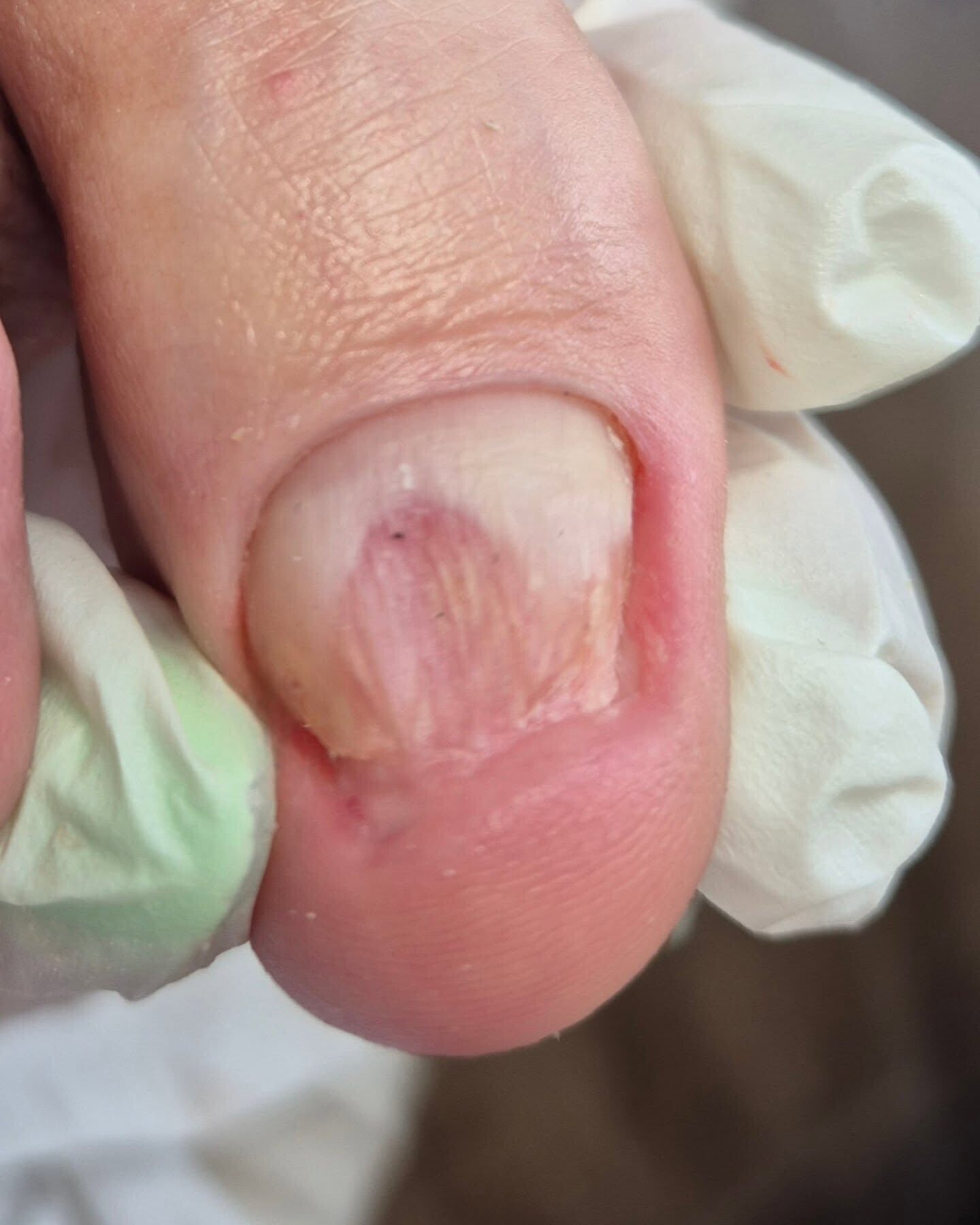 nagel zuiver gemaakt