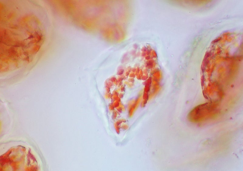 Hagebutte Zellen unter dem Mikroskop