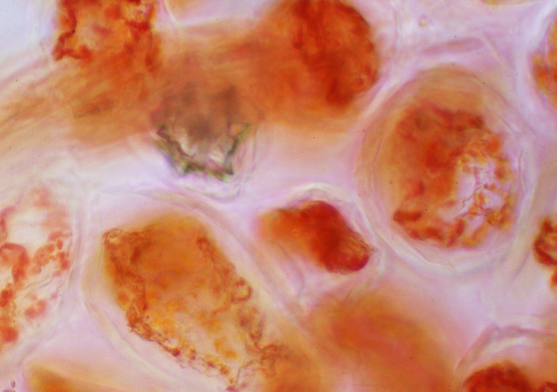 Zellen der Hagebutte unter dem Mikroskop, MicroMuse studios Mikrofotografie