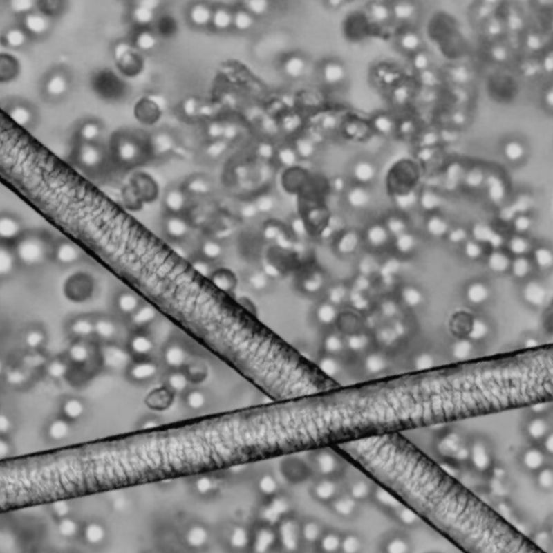 Mikroskopisches Selbstportrait - Zellen unter dem Mikroskop, Haarsträhne, Blut, 40-400x vergrößert | Microscopic Self-Portrait, cells and a strand of hair