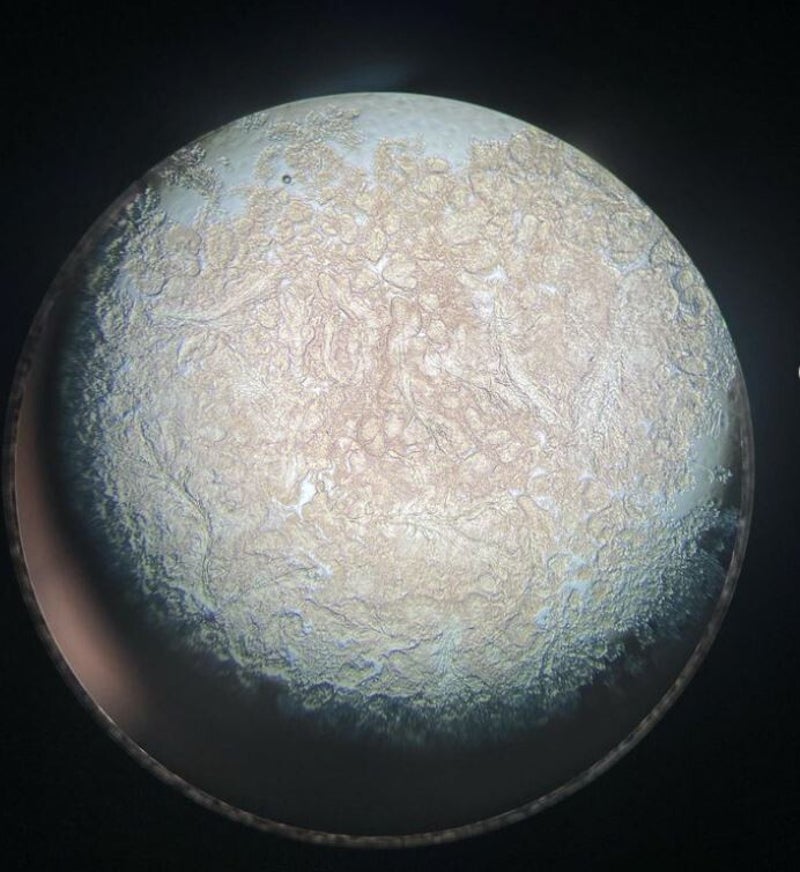 Zellen und Proteine auf Objektträger durchs Mikroskop betrachtet sehen aus wie ein anderer Planet. Erinnert an Enceladus, Europa oder Icy Moon. Mikrofotografie, Motic BA310E