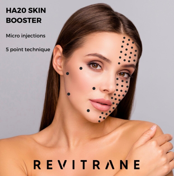 Injectable Skin boosters & under eye booster treatment