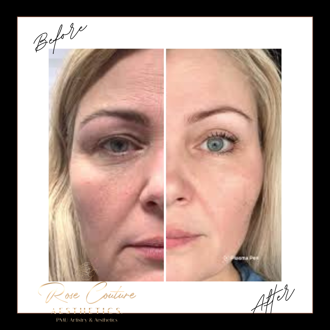 ivory-minimalist-before-and-after-skincare-beauty-instagram-post-standard-vupy6q.png