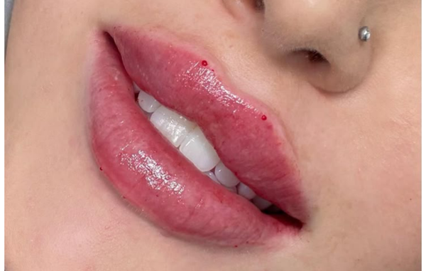 Best Practitioner Liverpool