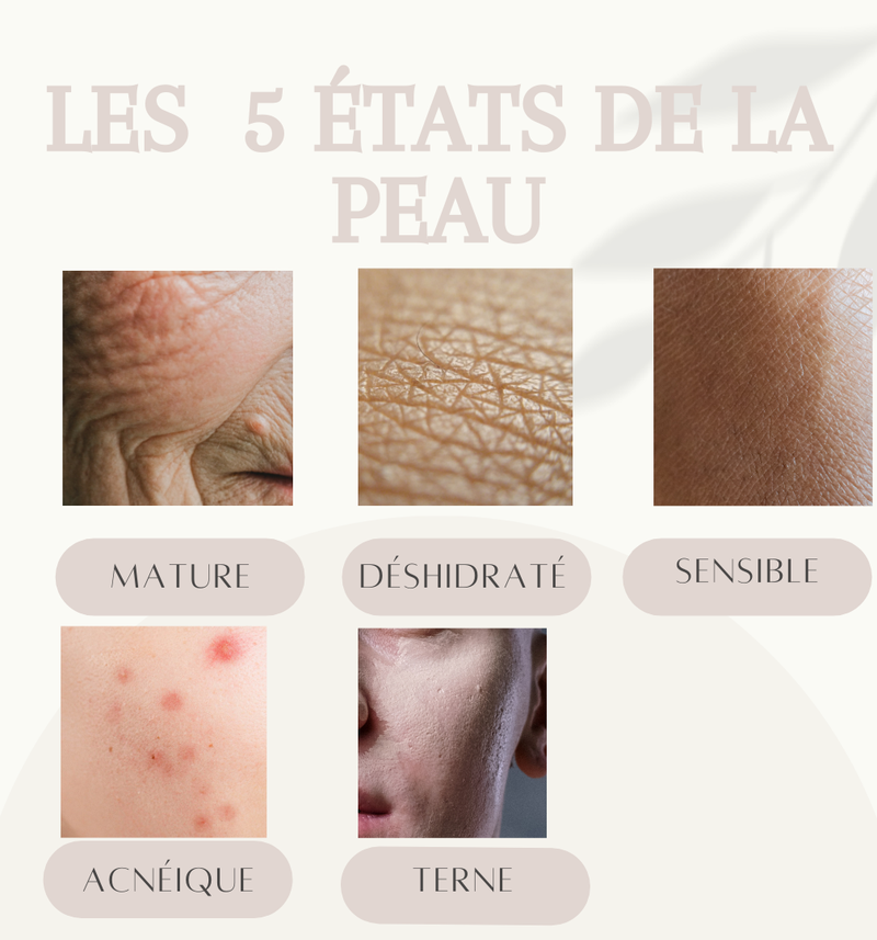 Les types de peaux | Sofia Beauté