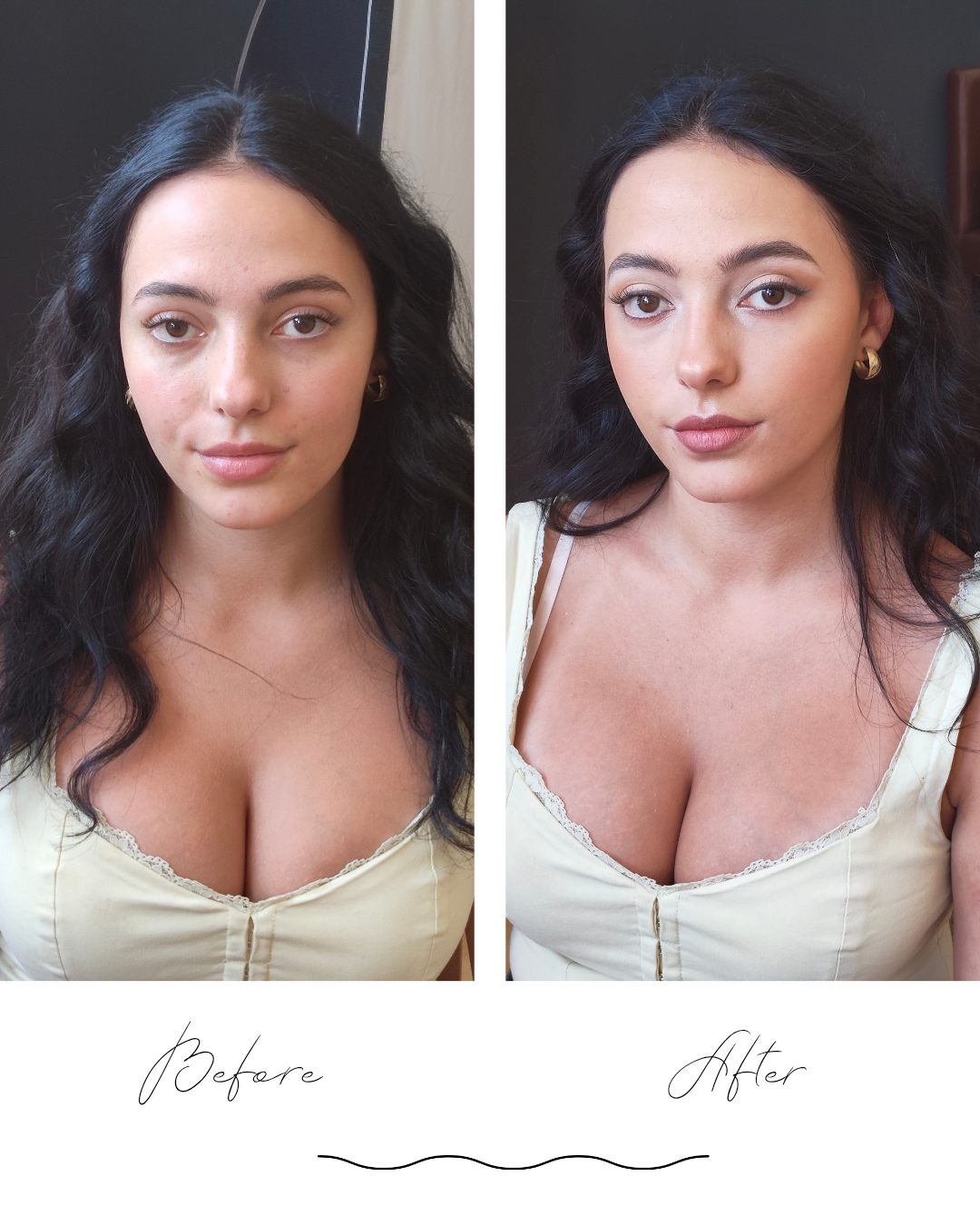 neutral-minimalist-skincare-before-and-after-instagram-post_20260624_143921_0000-standard.png