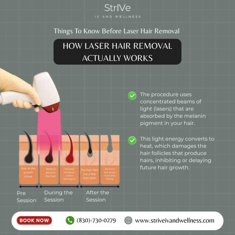 Things To Know Before Laser Hair Removal in New Braunfels, TX