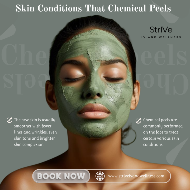 Chemical Peels in New Braunfels, TX