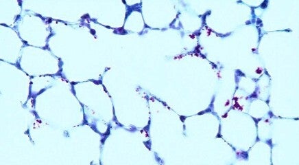 Acid Fast Bacteria Control Slides